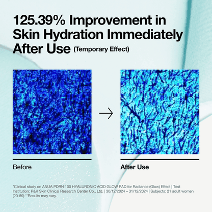 [Anua] PDRN 100 Hyaluronic Acid Glow Pad 180ml 60ea