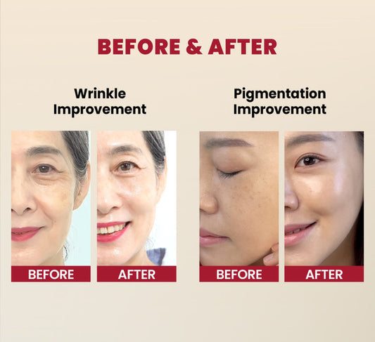 [K-Secret] Seoul 1988 Serum: Retinal Liposome 2% + Black Ginseng 30ml