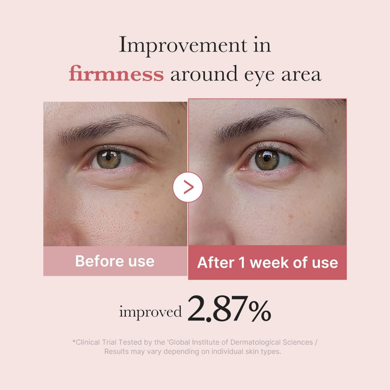 [Medicube] PDRN Pink Peptide Eye Cream 30ml
