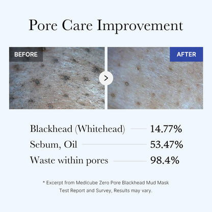 [Medicube] Zero Pore Blackhead Mud Mask 100g
