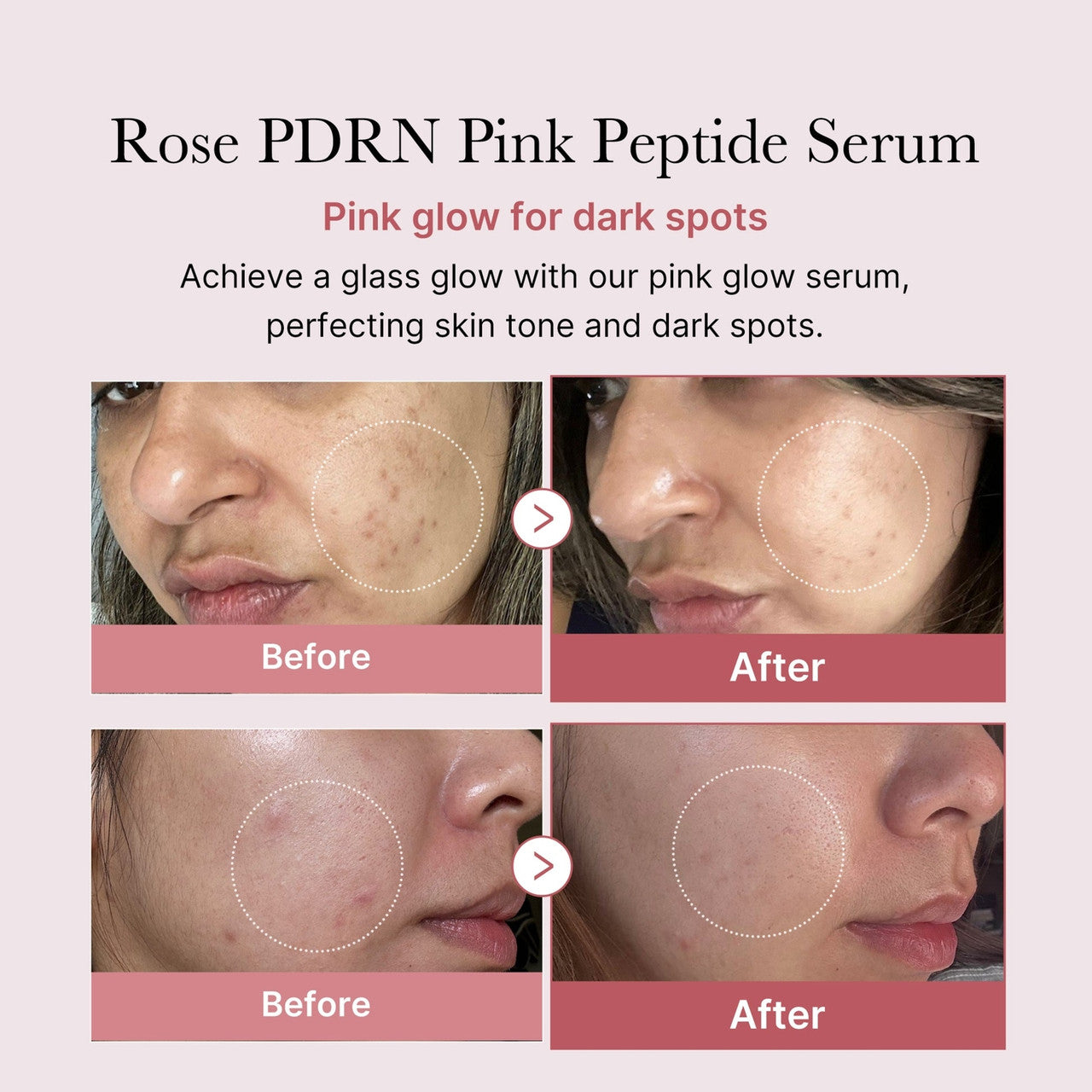 [Medicube] PDRN Pink Peptide Serum 30ml