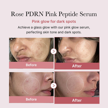 [Medicube] PDRN Pink Peptide Serum 30ml