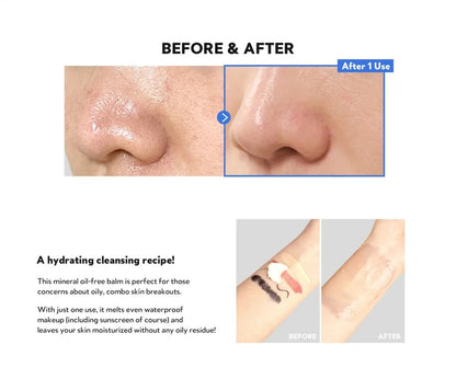 [TirTir] Hydro Boost Enzyme Cleansing Balm 120ml