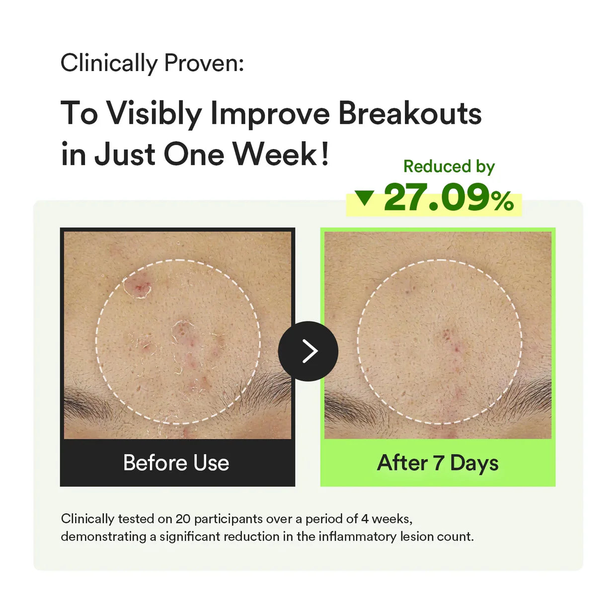 [Abib] Heartleaf TECA Capsule Serum Calming Drop 50ml