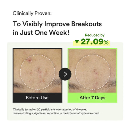 [Abib] Heartleaf TECA Capsule Serum Calming Drop 50ml