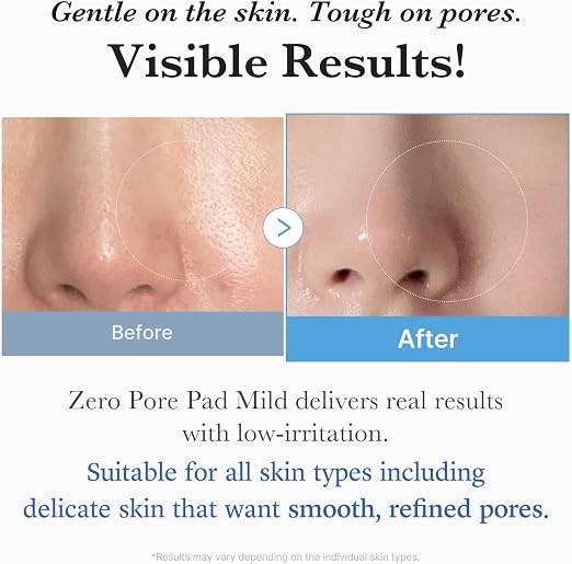 [Medicube] Zero Pore Mild Pad (70ea)