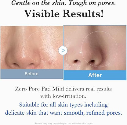 [Medicube] Zero Pore Mild Pad (70ea)