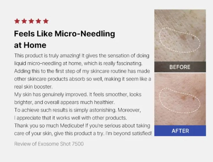 [Medicube] One Day Exosome Shot Pore Ampoule 7500 30ml